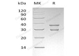 Recombinant Human UBE2J2 Protein (GST Tag)