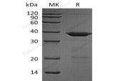 Recombinant Human HIP2/UBE2K Protein (His Tag, SUMO Tag)