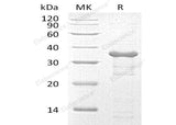 Recombinant Human UBE2R2/UBC3B Protein (His Tag)