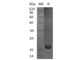 Recombinant Human UBE2V1 Protein (His Tag)