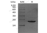 Recombinant Human UBE2V2/DDVIT1 Protein (His Tag)