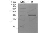 Recombinant Human UBE2Z Protein (His Tag)