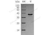 Recombinant Human GALE Protein (His Tag)