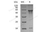 Recombinant Human UBA5 Protein (His Tag)