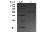 Recombinant Human UPRT Protein (His Tag)