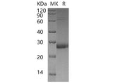 Recombinant Human Uroplakin-2/UPK2 Protein (His Tag)