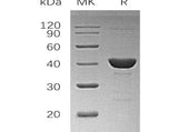 Recombinant Human UROD Protein (His Tag)