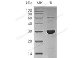 Recombinant Human UROS/UROIIIS Protein (His Tag)