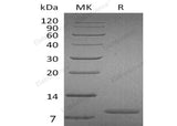 Recombinant Human UGRP1 Protein