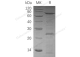 Recombinant Human VCP Protein (His Tag)