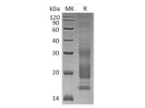 Recombinant Human VIP Protein (His Tag)