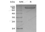 Recombinant Human Vasorin/VASN Protein (His Tag)