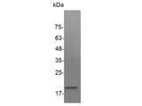 Recombinant Human VEGF-A/VEGF121 Protein (Active)