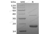 Recombinant Human VEGF-D/VEGFD Protein (His Tag)