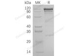 Recombinant Human VCL/Vinculin Protein