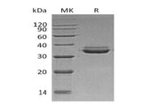 Recombinant Human LMAN2L Protein (His Tag)