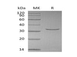 Recombinant Human VSNL1 Protein (His Tag)