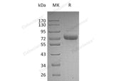 Recombinant Human Vitronectin/VTN Protein (His Tag)