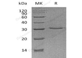 Recombinant Human VSIG8 Protein (His Tag)