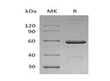 Recombinant Human VSIG8 Protein (Fc Tag)