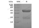 Recombinant Human VSTM2A Protein (His Tag)