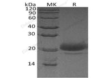 Recombinant Human WFDC2/HE4 Protein (His Tag)