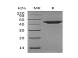 Recombinant Human Wnt Inhibitory Factor 1/WIF1 Protein (His Tag)