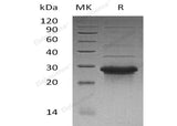 Recombinant Human WBP1 Protein (His Tag)