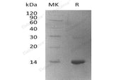 Recombinant Human WBP2 Protein (His Tag)