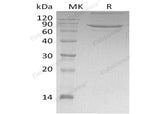 Recombinant Human XXPNPEP1 Protein (His Tag)