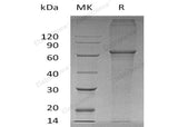 Recombinant Human XPNPEP3 Protein (His Tag)