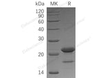 Recombinant Human ZBTB17/Miz-1 Protein (His Tag)