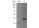 Recombinant Human ZBP1 Protein (His Tag)