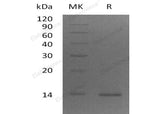 Recombinant Human ZBED1 Protein (His Tag)