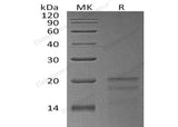 Recombinant Human ZNHIT1 Protein (His Tag)