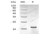 Recombinant Human ZNF100 Protein (His Tag)