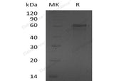 Recombinant Human ZNF70 Protein (His Tag)