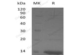 Recombinant Human ZNF75A Protein (His Tag)