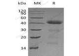 Recombinant Human ZAG/AZGP1 Protein (His Tag)