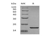 Recombinant Human ZG16 Protein (His Tag)