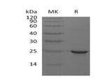 Recombinant Human CRYAB Protein (His Tag)