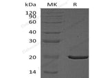 Recombinant Human CRYAA Protein (His Tag)