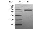 Recombinant Human Alpha-Galactosidase A/GLA Protein (His Tag)