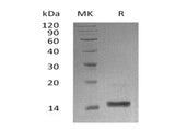 Recombinant Human α-Lactalbumin/LALBA Protein (His Tag)