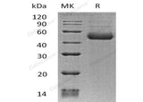 Recombinant Human ST8SIA1 Protein (His Tag)