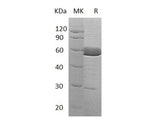 Recombinant Human Alpha-Parvin/PARVA Protein (His Tag)