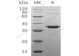 Recombinant Human SNAP-alpha/NAPA Protein (His Tag)