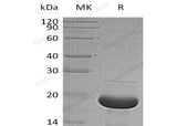 Recombinant Human Alpha-Synuclein/SNCA Protein (His Tag)