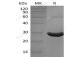 Recombinant Human TXLNA Protein (His Tag)