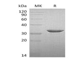 Recombinant Human B3GAT3 Protein (His Tag)